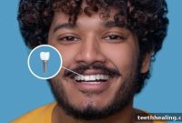 Transform Your Smile with Dental Implants