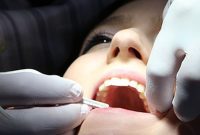 Gentle Dental Repairs