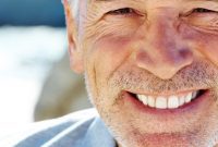Is Your Smile Adding Years to Your Face?