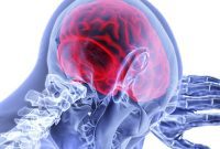 Better Teeth, Lower Stroke Risk