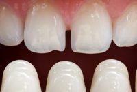 Reinvent Your Smile