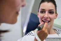 Unlock Your Natural Radiance: The Beauty of Metal-Free Dental Restorations