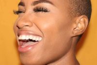 Transform Your Smile With Inlays Crowns And Veneers