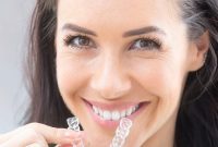 Invisible Braces Find Your Perfect Match