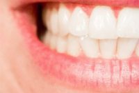 Teeth Whitening Your Smile Has Secrets