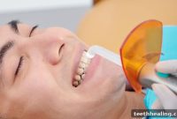 Revitalize Your Smile: Expert Composite Fillings
