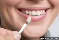 Natural Charm or Polished Perfection: Finding Your Ideal Veneer Style