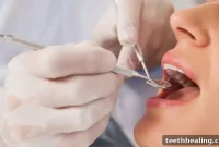 Choosing Your Ideal Dentist in Palm Desert A Full Guide