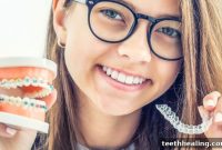 Clear Choice: Invisalign or Braces for Your Smile?