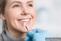 Porcelain Veneers Natural Beauty or Obvious Enhancement