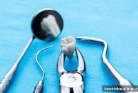 Determining the Optimal Age for Tooth Extraction