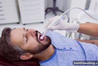 Root Canal Recovery: Your Dentist Answers Common Questions