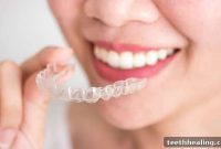 Eating with Invisalign: What You Need to Know