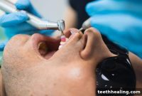 Regular Cleanings Your Key to Confident Fresh Breath