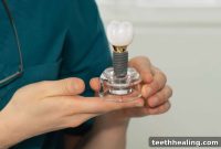 Maximizing Your Dental Implant Lifespan: Essential Maintenance Tips