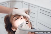 Your 5-Step Action Plan for Dental Emergencies